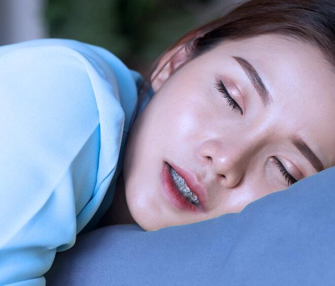 Bruxismo no sono: o que é, causas, sintomas e tratamentos